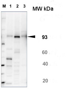 western blot using anti-SUS1 antibodies